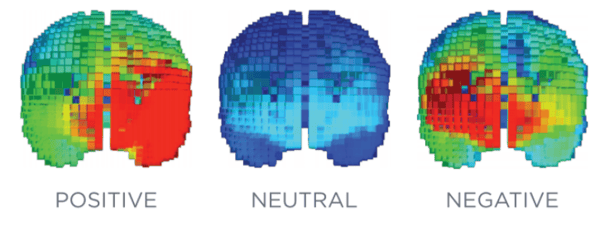 3 brains scans