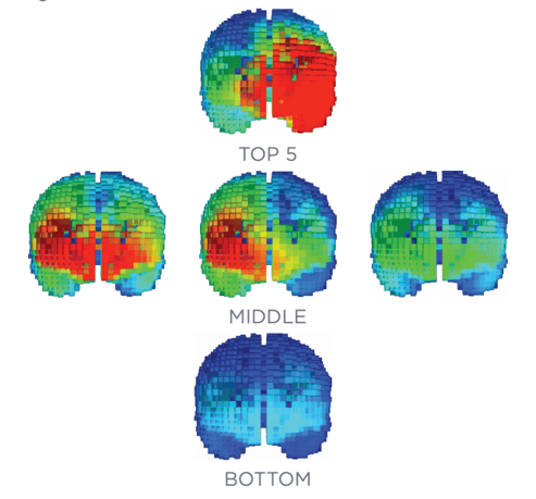 5 brain scans