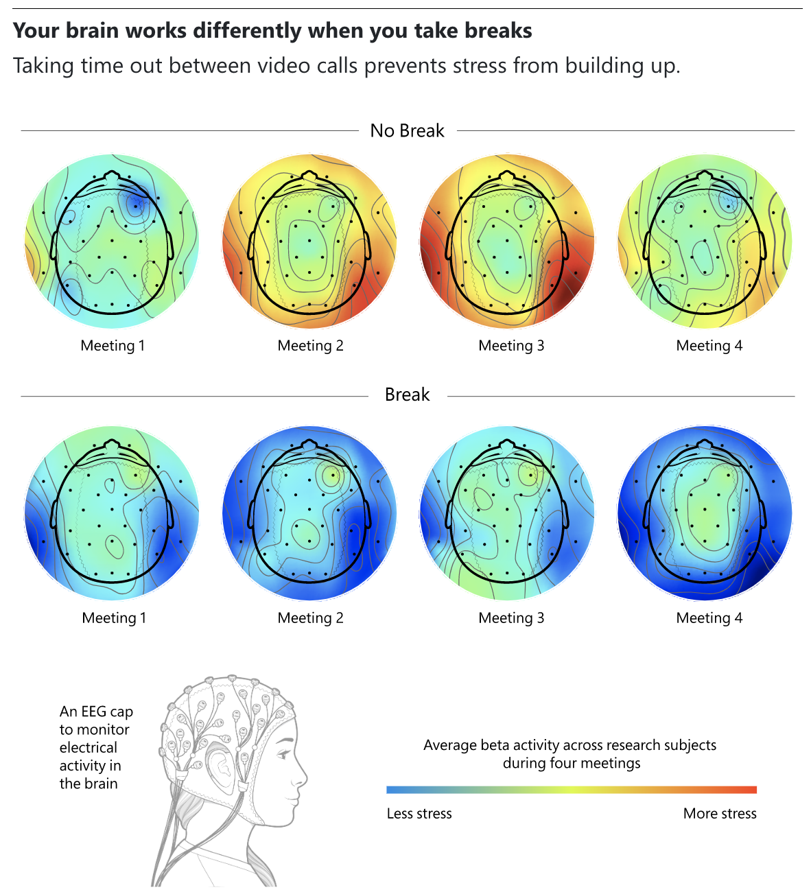 Brain Images - Microsoft Research